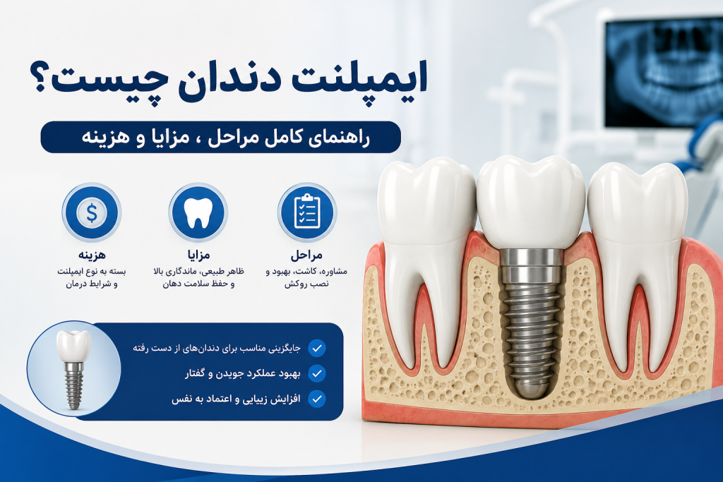پزشک در حال مشاوره درباره ایمپلنت دندان دیجیتال با نمایش مدل سه‌بعدی ایمپلنت و طراحی درمان در کلینیک دندانپزشکی ماندگار.