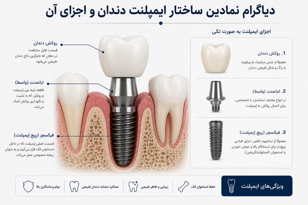 دیاگرام نمادین ساختار ایمپلنت دندان و اجزای آن
