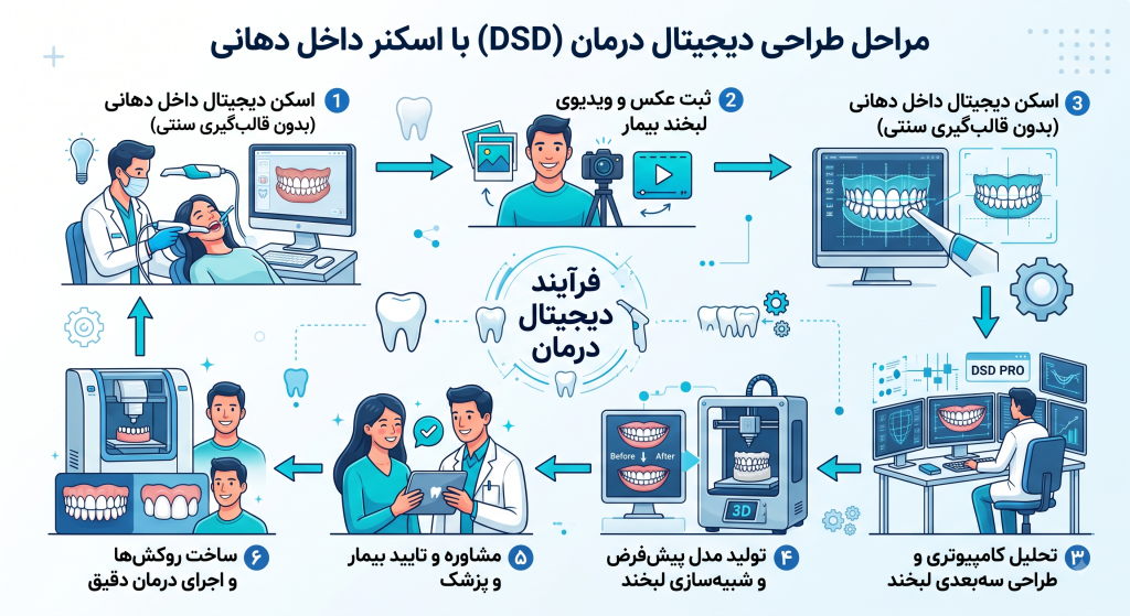 اینفوگرافیک مراحل ۶گانه طراحی دیجیتال لبخند (DSD)، از اسکن اولیه با اسکنر داخل دهانی تا ساخت روکشها و اجرای نهایی درمان.