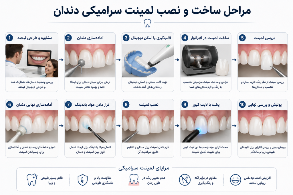 دیاگرام مراحل ساخت و نصب لمینت سرامیکی دندان شامل مشاوره، طراحی لبخند، آماده‌سازی دندان، اسکن دیجیتال، ساخت لمینت، نصب، باندینگ، تثبیت و پولیش نهایی.