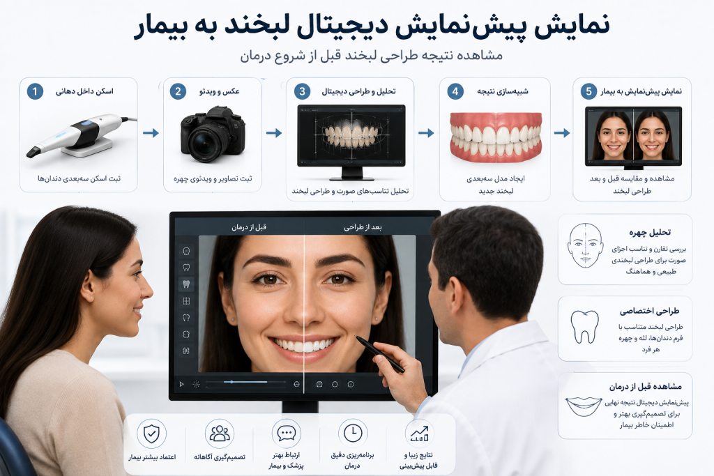 دیاگرام نمادین نمایش پیش‌نمایش دیجیتال لبخند به بیمار قبل از شروع درمان با فناوری طراحی لبخند دیجیتال (DSD)